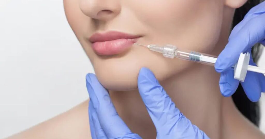 Debunking Myths The Truth About Pain with Lip Fillers