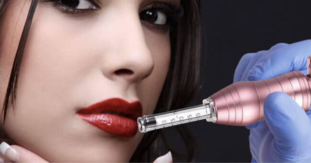 Needle-Free Lip Augmentation Procedure and Process