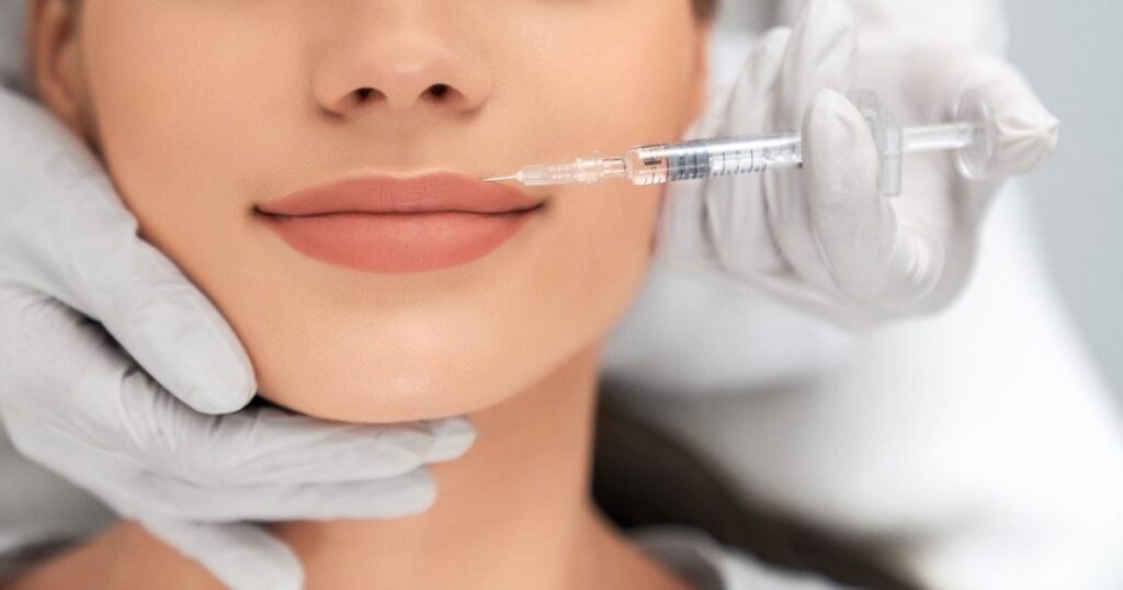 Subtle Lip Fillers Finding Confidence in a Delicate Enhancement