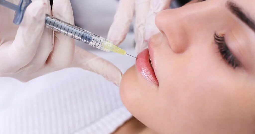 Lip Fillers: Alternatives and Considerations