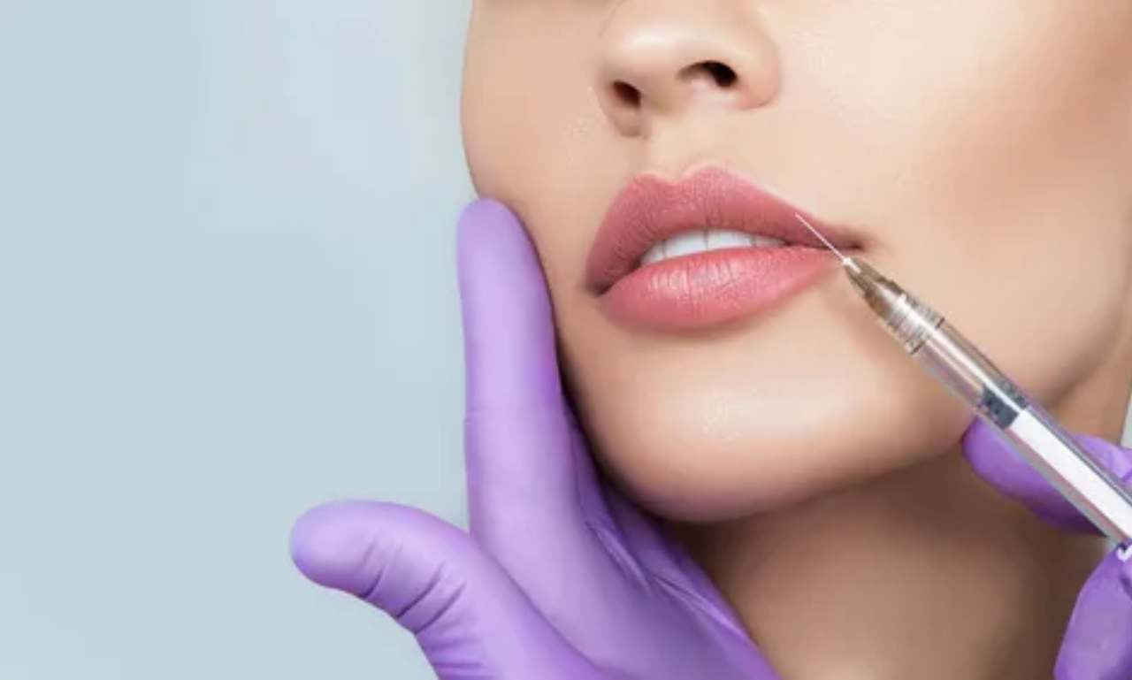 4 TYPES OF LIP FILLER: WHICH LIP FILLER IS BEST FOR YOU