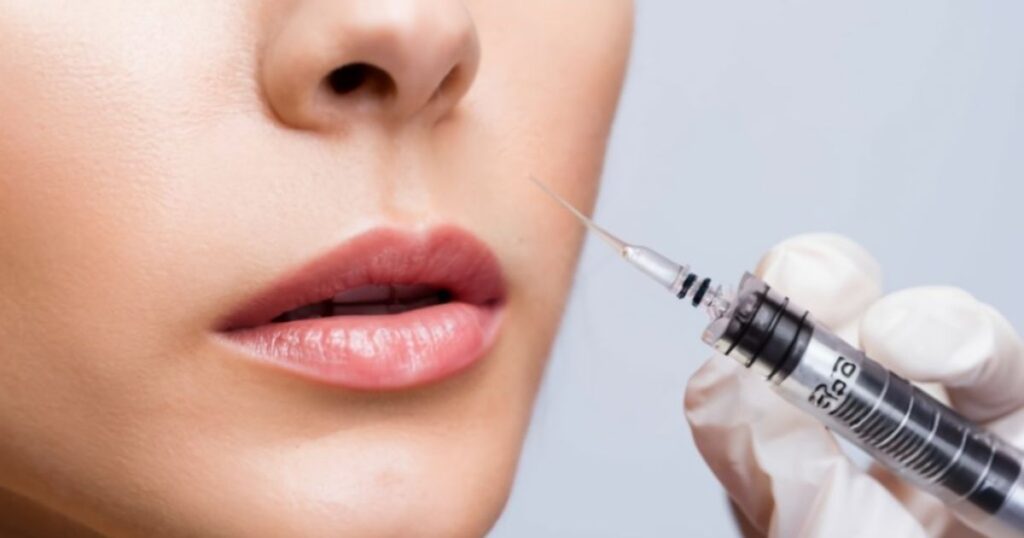 The Science Behind Half Syringe Lip Injections